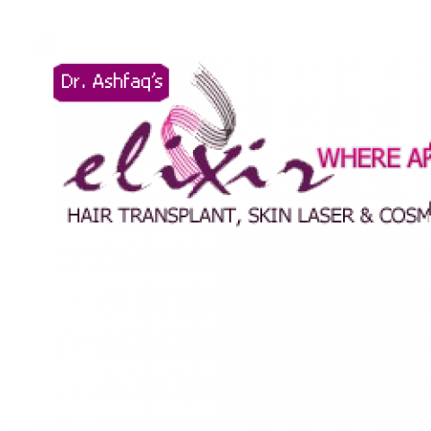 Elixir Hair Transplant in Center in Islamabad