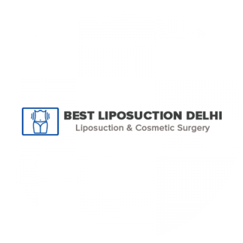Best Liposuction Delhi