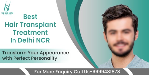 Hairsmith - hair transplant treatment delhi ncr