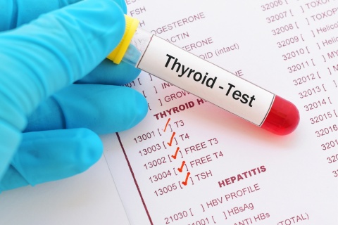 Redcliffe Labs - Thyroid Function Test in Delhi