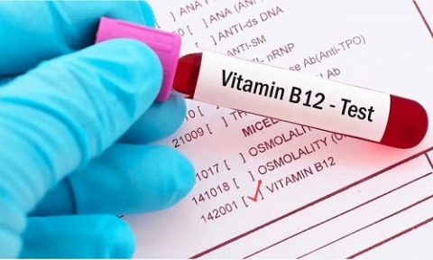 Redcliffe Labs - Vit B12 test price at a just price of Rs.549/-