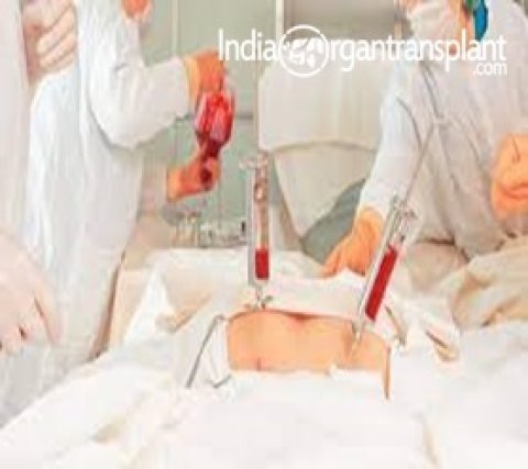 Bone Marrow Transplant Cost India