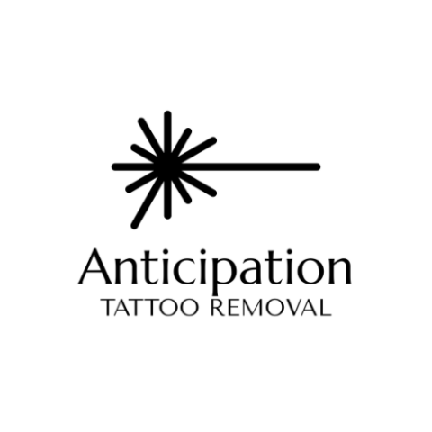 Anticipation Tattoo Removal