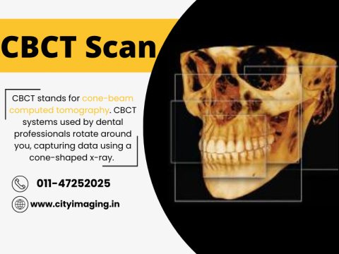 Best Place For CBCT Scan Near Me In Delhi