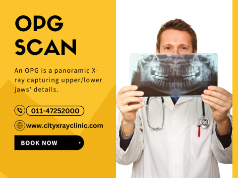 OPG X-Ray Near Me In Delhi At Affordable Price