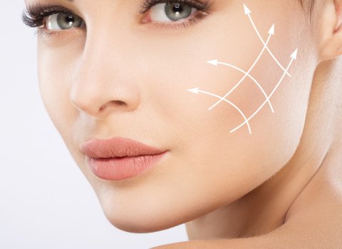Cheek Fillers Injections in Dubai