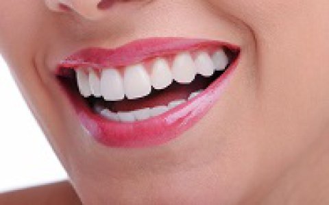 Best Teeth Whitening in Brighton East – BEDC