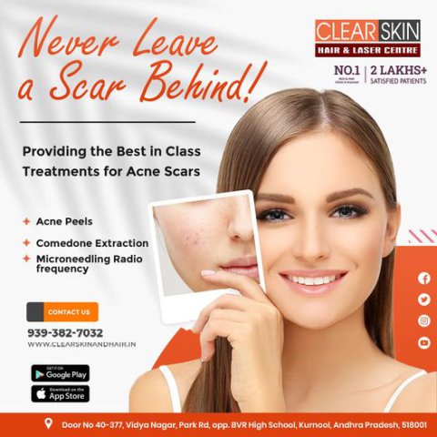 Clear Skin Hair and Laser Center
