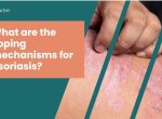 Permanent Solution for psoriasis