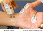 NCV Test Price Affordable Costs and What to Expect