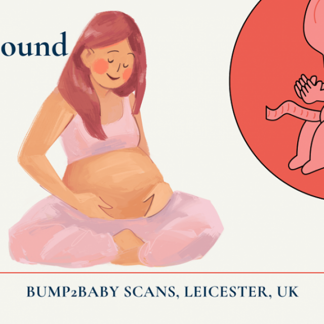Baby Scan in Leicester: Bump2baby Scans