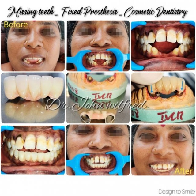 dental clinic in thirunagar madurai | dentist in madurai | AJ Dental Clinic