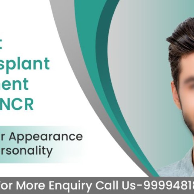 Hairsmith - hair transplant treatment delhi ncr