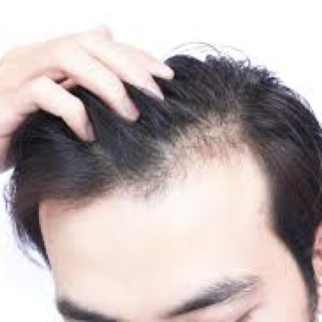 Best Hair Loss Clinic