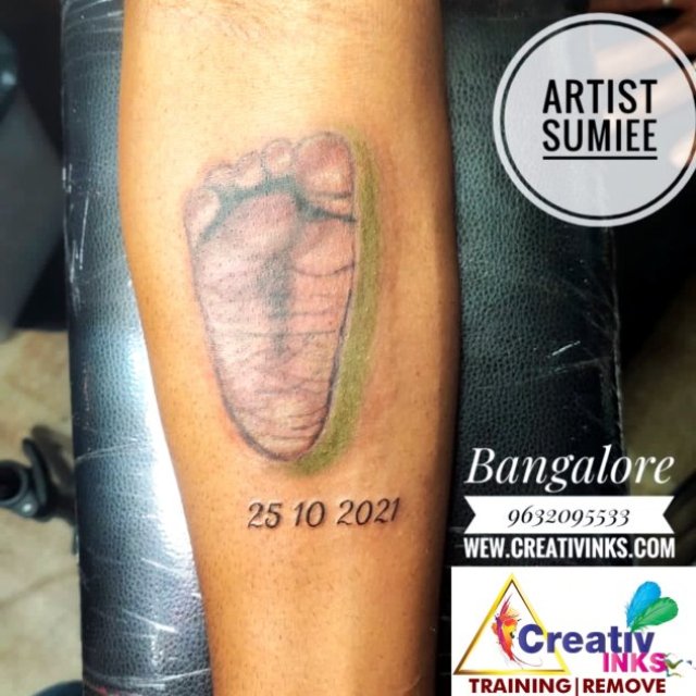 Creativinks-Tattoo Removal in Bangalore