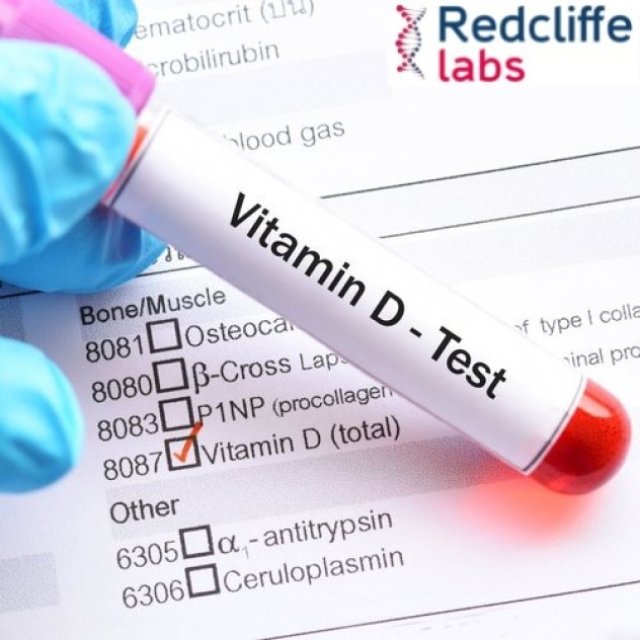 Vitamin Test Profile in Kanpur - Redcliffe Labs