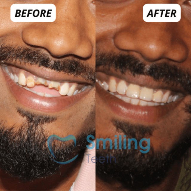 Smiling Teeth - Dental Clinic