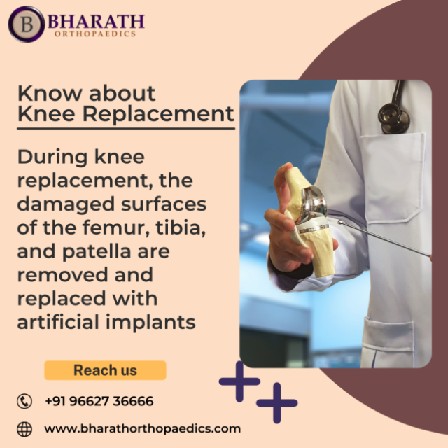 Total Knee Replacement in Chennai