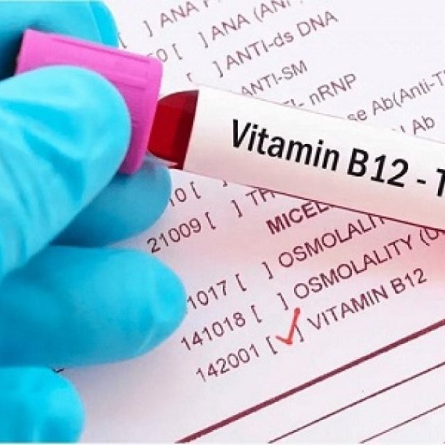 Redcliffe Labs - Vit B12 test price at a just price of Rs.549/-