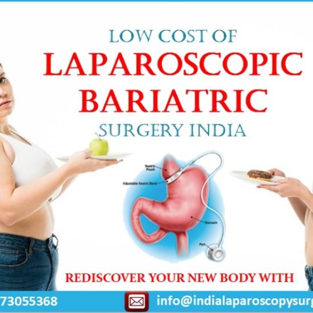 Cost of Laparoscopic Bariatric Surgery India/