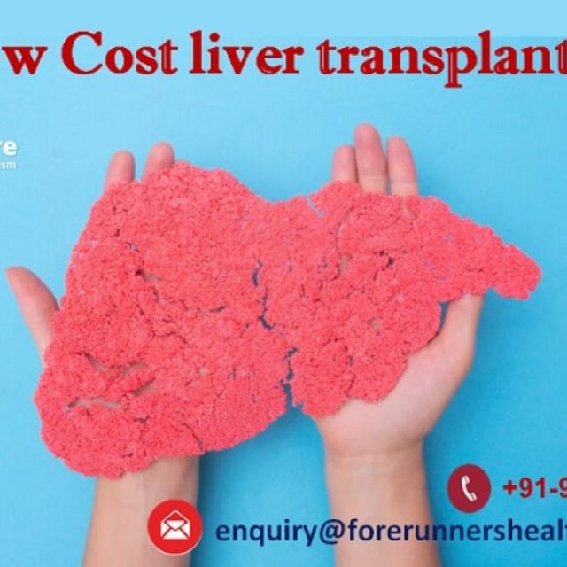 Low Cost liver transplant india