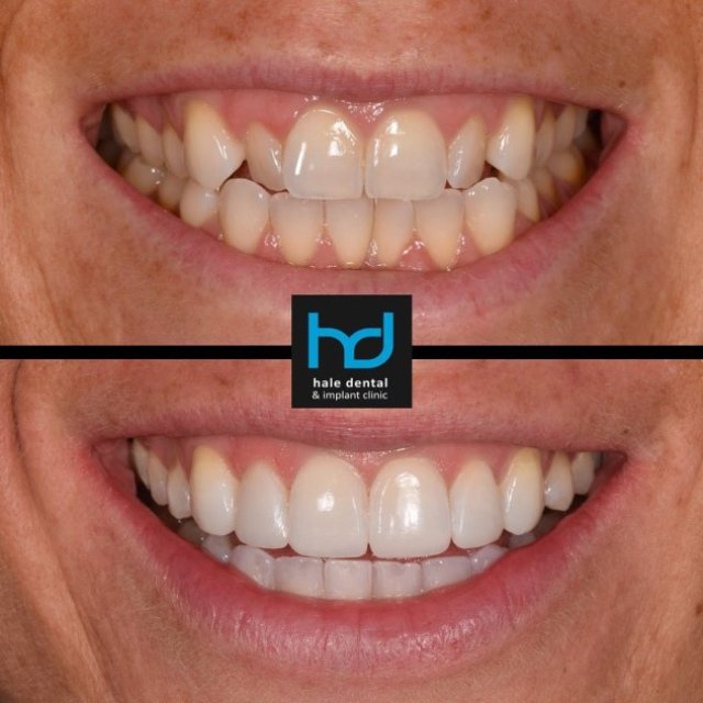 Hale Dental and Implant Clinic