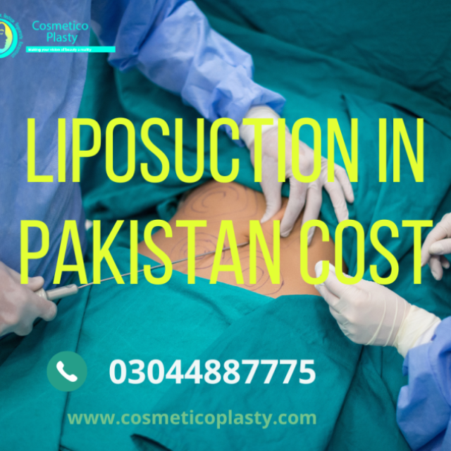 Liposuction in Pakistan cost