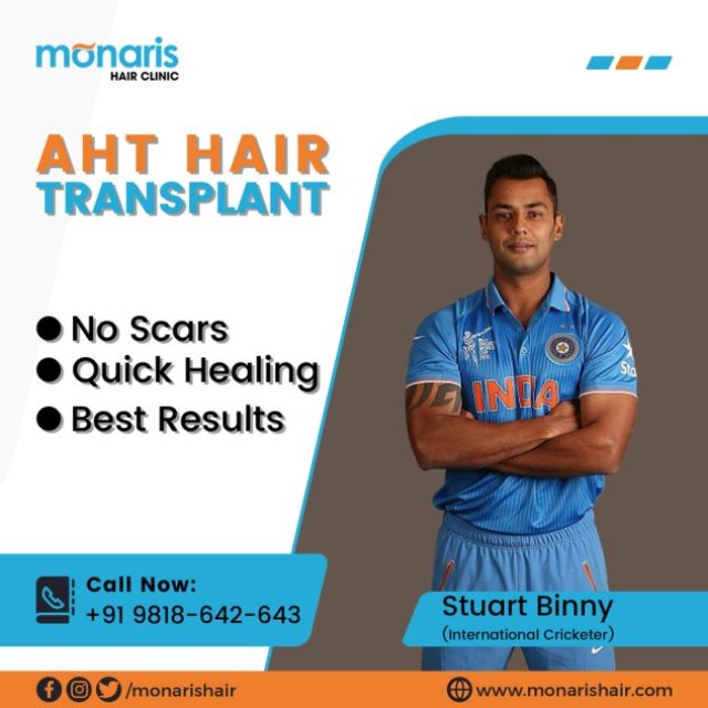 Natural Looking Hair Transplant in Delhi at Monaris Hair Clinic