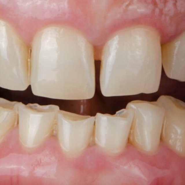 Dentist South Plainfield NJ | Dental Cosmetic