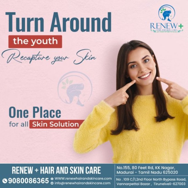Renew Plus Hair and Skin Care -  Hair Transplantation | Hair Clinic in Madurai