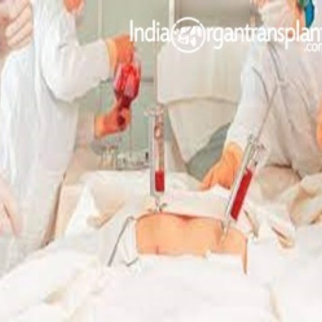 Bone Marrow Transplant Cost India