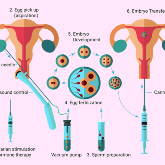 IVF Treatment in India