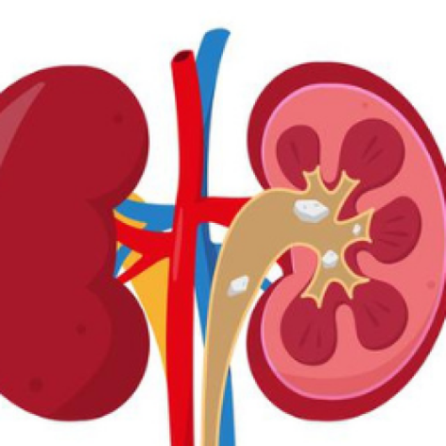 Kidney Treatment Cost in India
