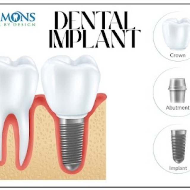 Ammons Dental by Design James Island