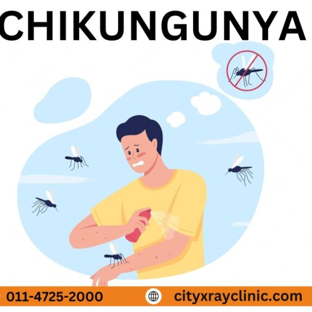 Discover Chikungunya Relief Now