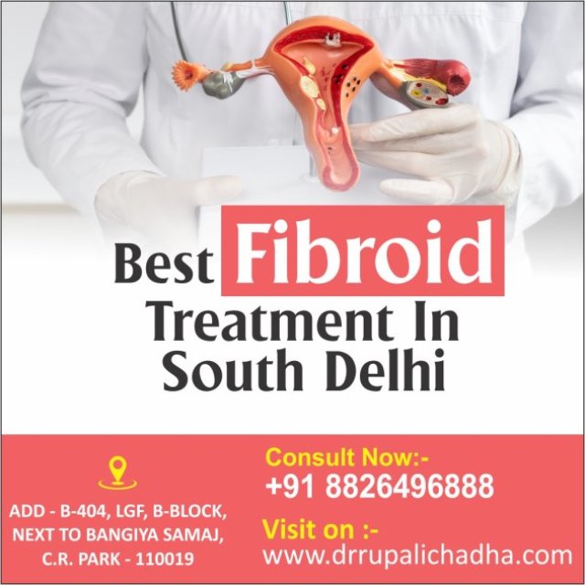 Who is Specialist Best Fibroid Treatment in South Delhi?
