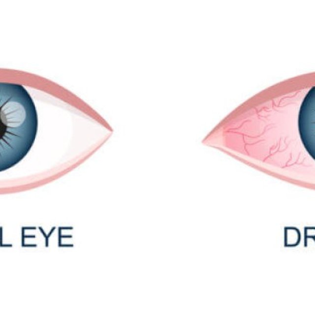 Excel Eye Hospital - Dr. Anisha Gupta - Eye specialists