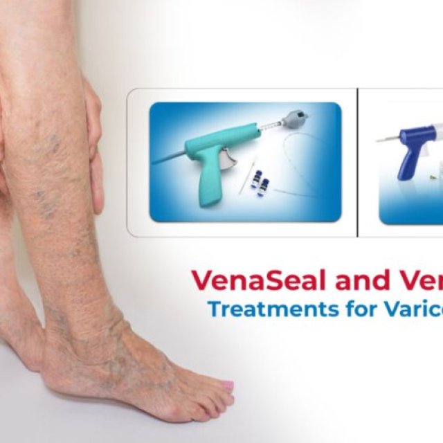 Endovenous Laser Ablation Treatment For Varicose Veins In Hyderabad