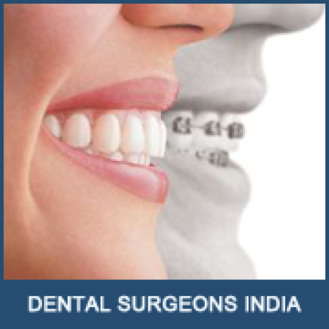 Low Cost Dental Surgery India