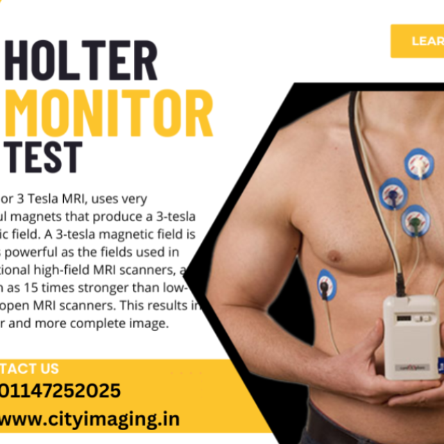 Best Place For Holter Monitor Test Near me  In Delhi