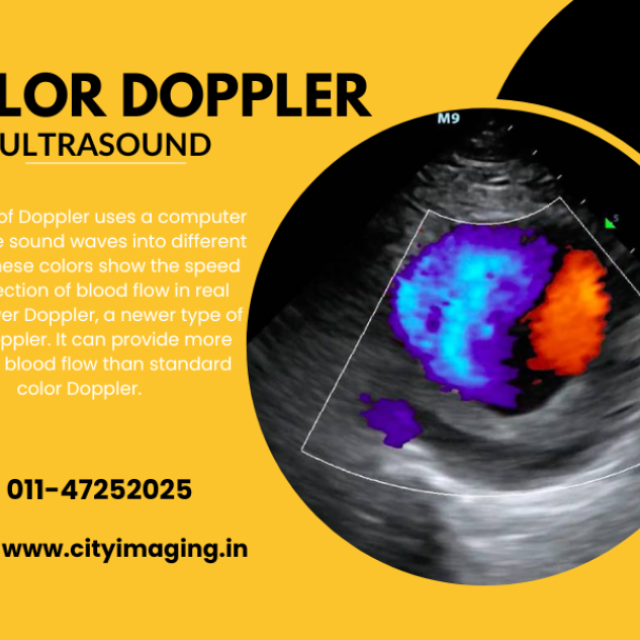 Advance Color Doppler Ultrasound scan Near Me In Delhi