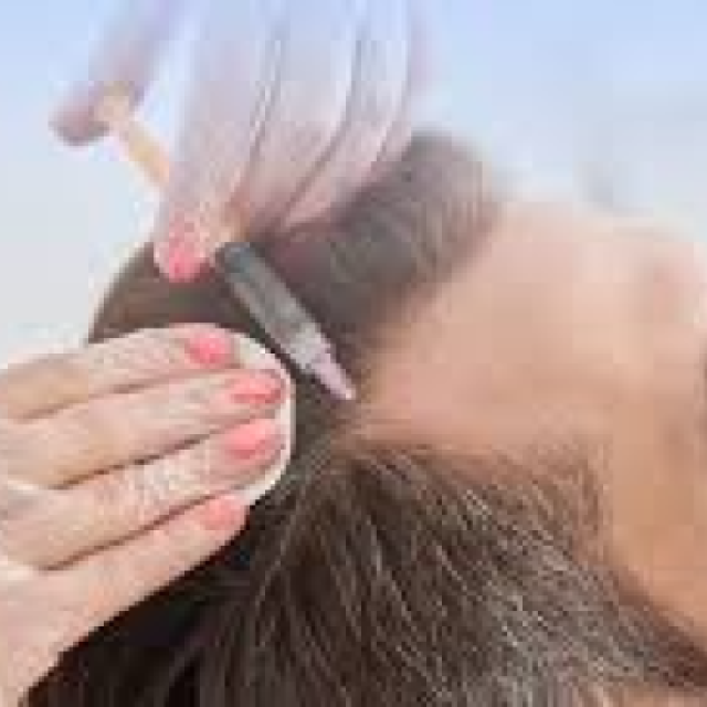 GFC Treatment For Hair In Dubai