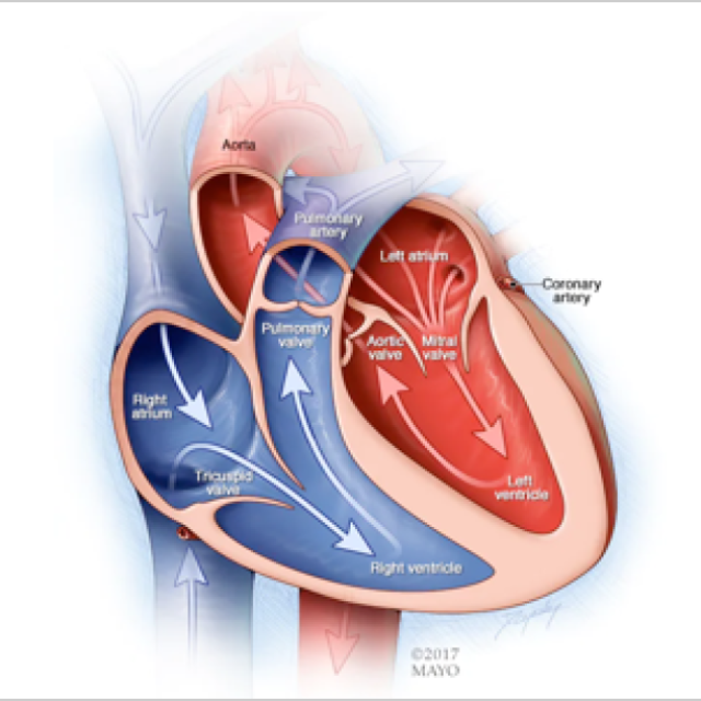 Coronary Artery Bypass Graft treatment in India