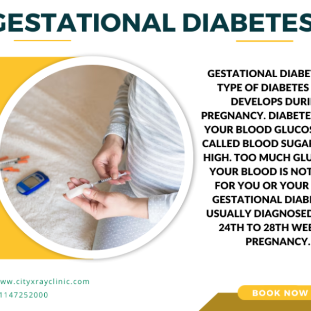 What Is Gestational Diabetes Its Symptoms, Prevention And Test