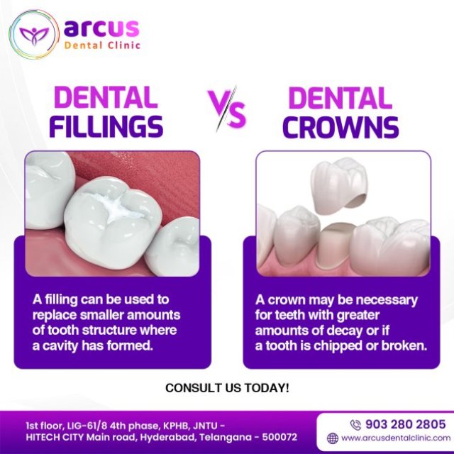 Arcus Dental Clinic In KPHB