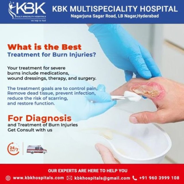 Best Hospital for Burns Treatment in Hyderabad