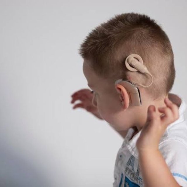 Top Hospitals for Cochlear Implant in India