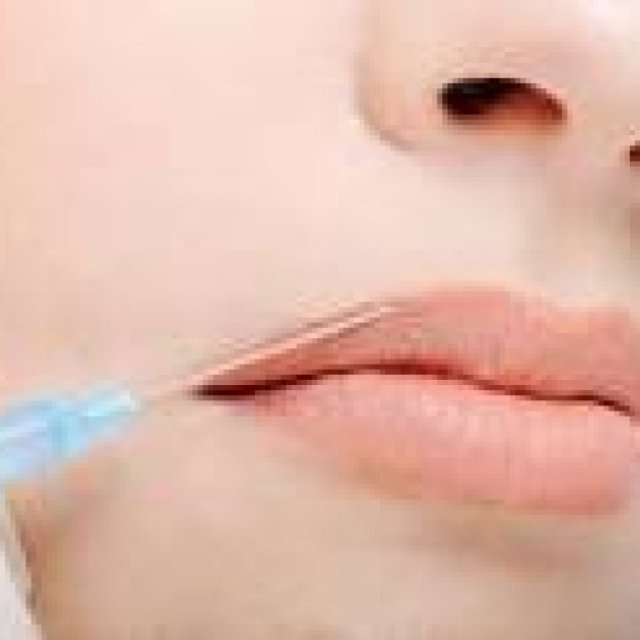 Fillers Injections in Riyadh