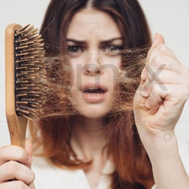 Hair Loss Treatment in Dubai