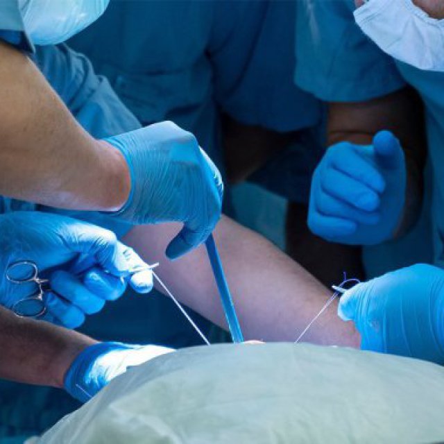 Penile Implant in Dubai